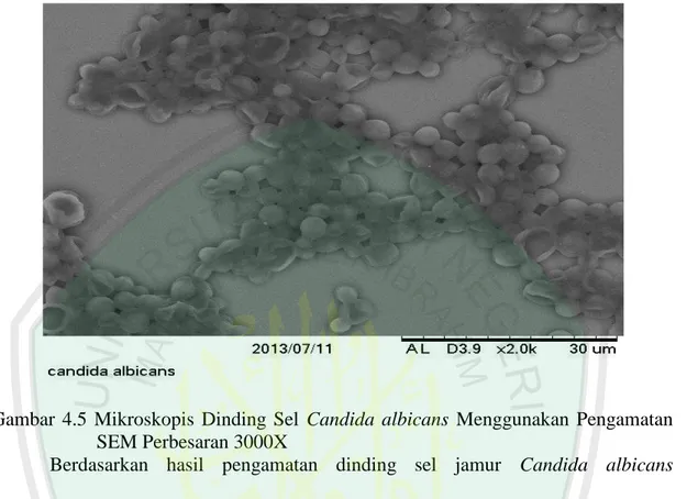 Gambar  4.5  Mikroskopis  Dinding  Sel  Candida  albicans  Menggunakan  Pengamatan  SEM Perbesaran 3000X 
