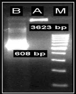 Gambar 2. Elektroforesis Hasil PCR Gen Rv1984c pada Plasmid Rekombinan   Keterangan: (A) = plasmid rekombinan; (B) = sampel hasil PCR gen Rv1984c 