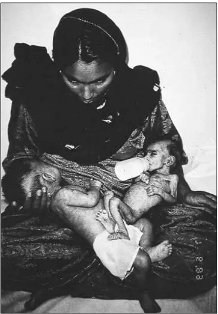 FIGURE 1–3. UNICEF photograph of thriving breast-fed twin and his dying bottle-fed sister
