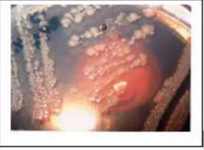 Gambar 1. Koloni bakteri Escherichia coli dalam media PDA 