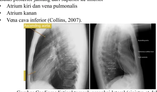 Gambar Cardiomedistinal tampak proyeksi lateral (sinistra et dektra) Dalam melakukan pembacaan X foto toraks jantung dilakukan  beberapa penilian antara lain yaitu: