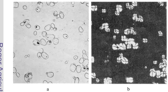 Gambar 3.    Pati sagu (perbesaran 188 x) : a. cahaya normal; b. cahaya polarisasi  (Moss, 1976 di dalam Radley, 1976) 
