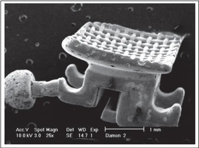 Gambar 2.1. Korosi pada braket metal.23