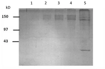 Gambar 2. Karakterisasi dan validasi konjugasi  Anti-EpCAM  terhadap nanopartikel  emas menggunakan SDS-PAGE