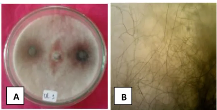 Gambar  6.  Jamur  Neurospora  sp.  (A)  Koloni  Neurospora  sp.,  dan  (B)  Hifa 