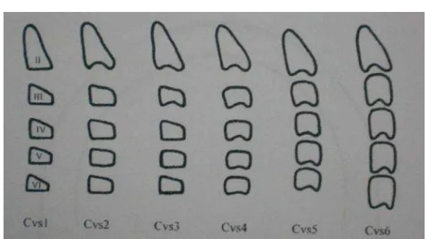Gambar 9. Vertebra servikal Cvs1 – Cvs6. 12