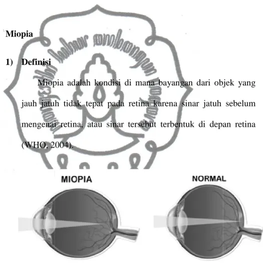 Gambar 2.2 2)  Klasifikasi