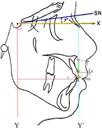 Gambar 1: Garis referensi 1. Panjang bibir atas    (Sn3. Retraksi gigi anterior maksila (Y-Is)`-STOs`); 2