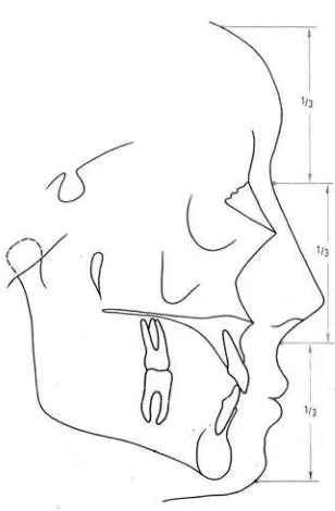 Gambar 3. Proporsi wajah vertical dengan tiga pembagian sama besar 17