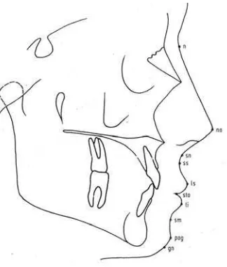 Gambar 4. Titik‐titik pada jaringan lunak hampir sama dengan titik‐titik pada skeletal 16