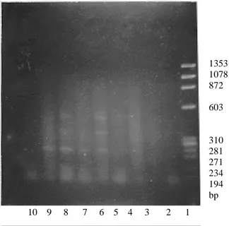 Gambar 1.  Hasil  elektroforesis  dari  PCR  terhadap  DNA  darah  manusia  sehat  yang  dicampur  suspensi  takizoit  dengan  target  gen  P30  menurut  metode Weiss dkk