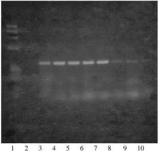Gambar 3.  Hasil  elektroforesis  dari  PCR  terhadap  DNA  darah  manusia  sehat  yang  ditambahkan  DNA murni T.gondii dengan  target  gen  P30