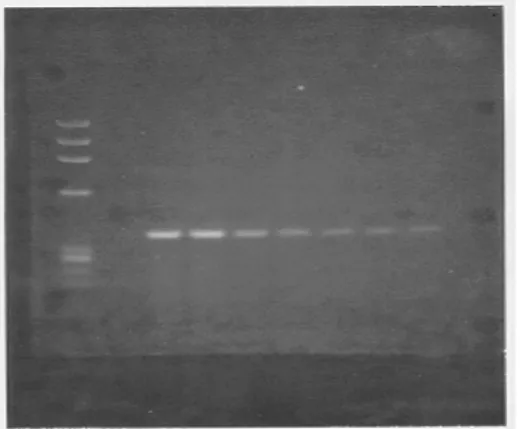 Gambar 5.   Hasil  elektroforesis  dari  PCR  terhadap  DNA  manusia  yang  diekstraksi  dan  DNA  manusia (Promega,USA) dengan target gen  P30