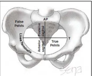 Gambar 2.1. Gambaran anteroposterior panggul normal wanita dewasa. Digambarkan diameter anteroposterior (AP) dan Transversal (T) pintu atas panggul