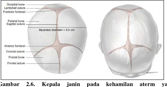 Gambar 2.6. Sumber: Cunningham, Kepala janin pada kehamilan aterm yang memperlihatkan ubun-ubun, sutura, dan diameter biparietal