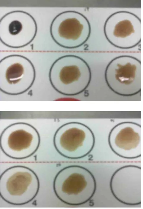 Gambar koloni S.aureus di media Mannitol Salt Agar (MSA) 