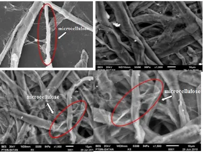 Figure 5. The Micrographs of (a) Microcellulose 5 μm SEM Image, Magnification 1000´; (b) Blank 