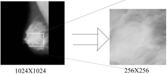 Gambar 3.10 ROI pada mammogram mdb001 