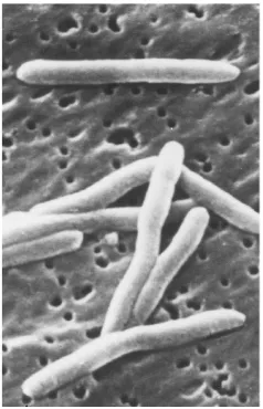 Gambar 3. Fusobacteria nucleatum.27 