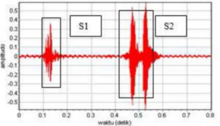 Gambar 2.1 Sinyal suara jantung normal satu siklus   (puspasari, arifin, &amp; Hendradi, 2012)