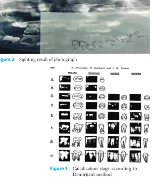 Figure 2 Sighting result of photograph