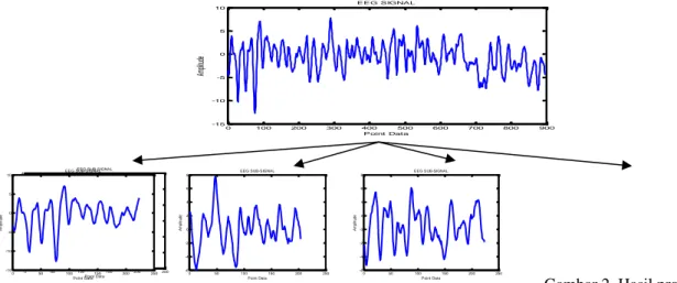 Gambar 2. Hasil proses Teknik  Sampling pada sinyal Epilepsi  