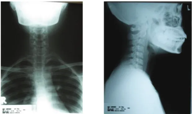 Figure 7  STL AP-Lateral picture shows nothing out of ordinary