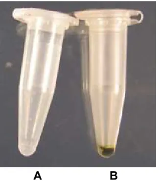 Fig. 1. The appearance (color) of precipitated root DNAs which were extracted using chemical coagulation (A) and DNA extraction kit (B)