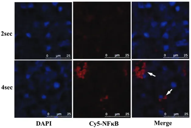 Figure 4  The relative expressions of NF-kB in APC (power of 40 W for 2 and 4 seconds, at days 3-28) treated rat liver tissue