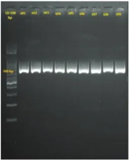 Figure 2  Electrophoregram product restriction PCR rs1058213 