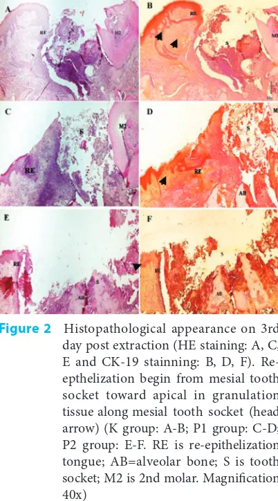 Figure 3Histopathological appearance on 7th day 