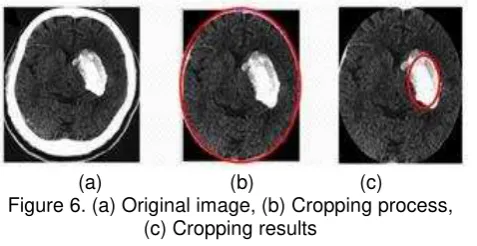 Figure 6. (a) Original image, (b) Cropping process, 