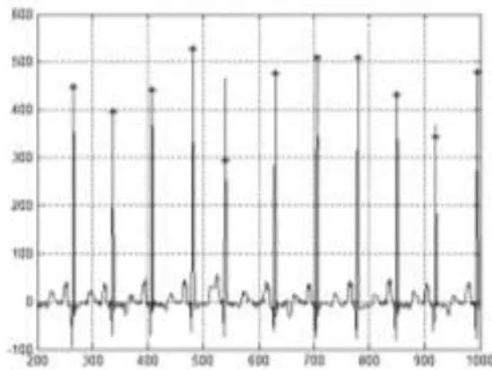 Gambar  13.  Hasil  Deteksi  QRS  kompleks,  gelombang  P  dan  T  pada  sinyal  100.dat 
