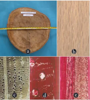 Figure 2. Castanopsis acuminatissima  - Fagaceae. (a) cross sectional surface of the stem (b) longitudinal surface, x 1 (c) transverse surface (macroscopic), x 10 (d) transverse surface (microscopic), x 40 (e) multiseriate rays > 10 seriate and uniseriate rays, x 40.