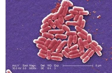 Gambar 2. Bentuk morfologi sel bakteri E. coli (sumber: britannica.com) 
