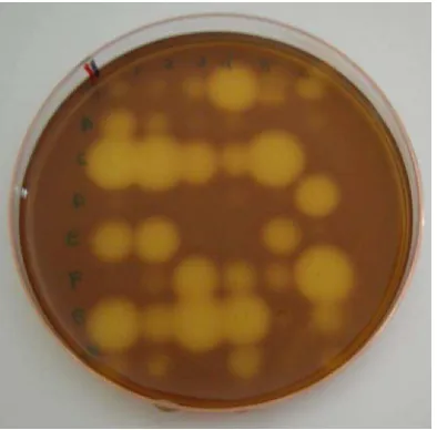 Gambar (Figure) 2. Modifikasi metode Gram’s Iodine (Kasana et al., 2008) yang diterapkan pada seleksi tahap pertama (Modified Gram’s Iodine methods which were applied during the first step of screening) 