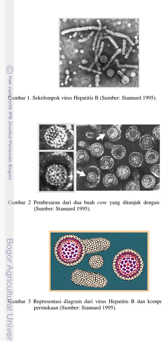 Gambar 1. Sekelompok virus Hepatitis B (Sumber: Stannard 1995). 