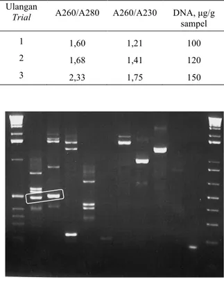 Gambar 2.  Profil elektroforesis dari  produk PCR Genome Walking. Pita DNA yang dilingkari adalah                     kandidat kuat untuk “walking” gen/DNA spesifik TcLFY