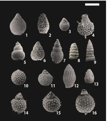 Figure 6. Scanning electron photomicrograph of Valanginian - Barremian radiolarians from manganese carbonate nodule of the Barru Complex, South Sulawesi