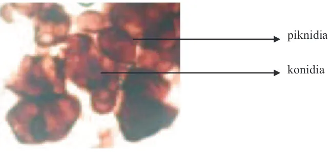 Gambar (Figure) 2. Piknidium Pyrenochaeta sp. (Picnidium of pyrenochaeta sp.)