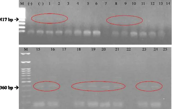Gambar 7 Hasil amplifikasi sampel DNA Crinivirus dari lapangan menggunakan metode RT-PCR