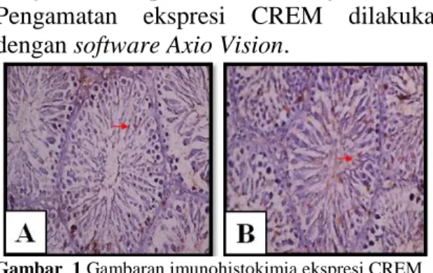 Gambar  1  (A)  menunjukkan  gambaran  imunohstokimia  ekspresi  CREM  testis  dalam  keadaan  normal,  dimana  pada  kondisi normal ekspesi CREM juga terdapat  pada testis