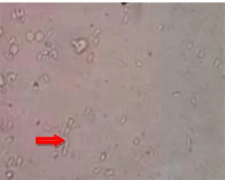Gambar 1.  Pemeriksaan natif stadium takizoit T. gondii dari cairan intraperitoneal  dilihat di mikroskop cahaya perbesaran 400X