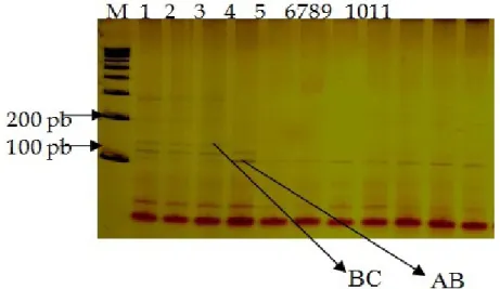 Gambar  2  memperlihatkan  alel  yang  teramplikasi  melalui  proses  PCR  pada  lokus  INRA035 pada sapi Bali