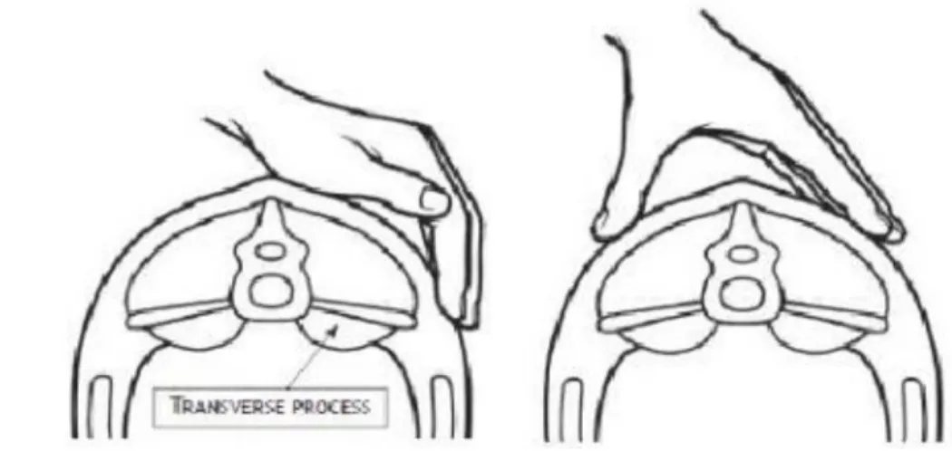 Gambar 1 Pengecekan loin dari samping dan atas (Sumber : Tames  2010)   Pemotongan  dilakukan  dengan  cara  memotong  bagian  atas  leher  dekat  rahang  bawah  atau  persendian  tulang  atlas  (occipito-atlantis),  sampai  semua  pembuluh  darah  (Vena  