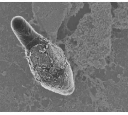 Gambar 2.28Clostridium botulinum merupakancontoh bakteri yang dapat