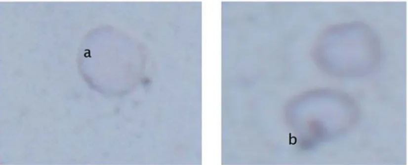 Figure 4. Antigen phagocytosis by phagocytic cells