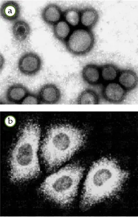 Gambar 2.6Klasifikasi virus berdasarkanasam nukleat. (a) Ribovirus,