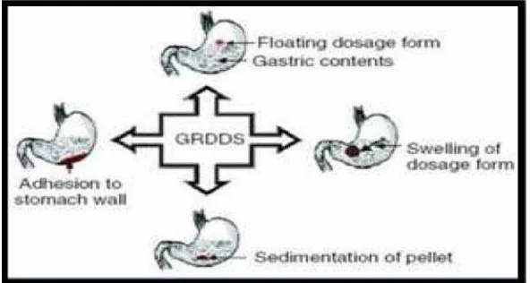 Gambar 2.2 Berbagai metode pendekatan sediaan Gastro Retentive 