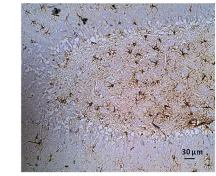 Gambar 13  Hasil pewarnaan dengan antibodi GFAP pada bagian hipokampus  pada  Kelompok level 3 yang diberi ekstrak etanol  daun pegagan